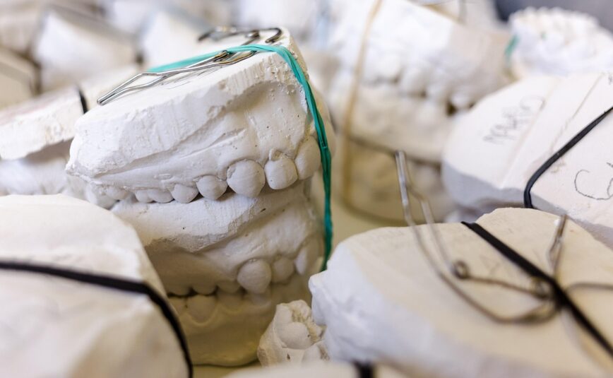 teeth, models, gypsum, dentist, dental, dentistry, dentist, dentist, dental, dental, dental, dental, dental