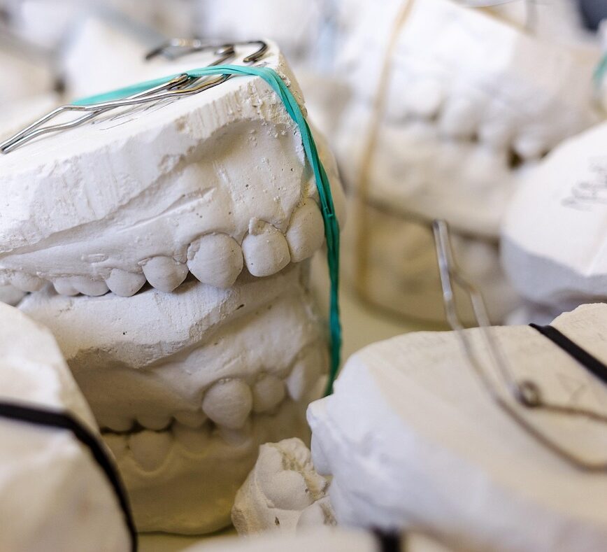 teeth, models, gypsum, dentist, dental, dentistry, dentist, dentist, dental, dental, dental, dental, dental