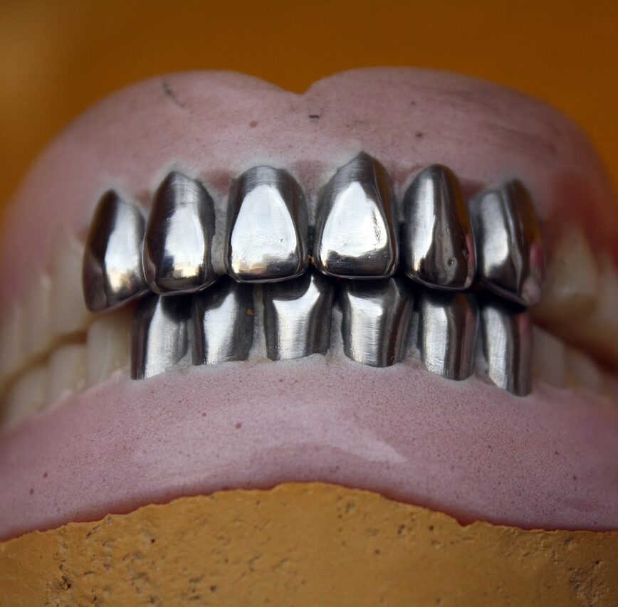 metal teeth, dental, denture, orthodontic, mouth, oral, brown teeth, dental, dental, denture, denture, denture, denture, denture, orthodontic