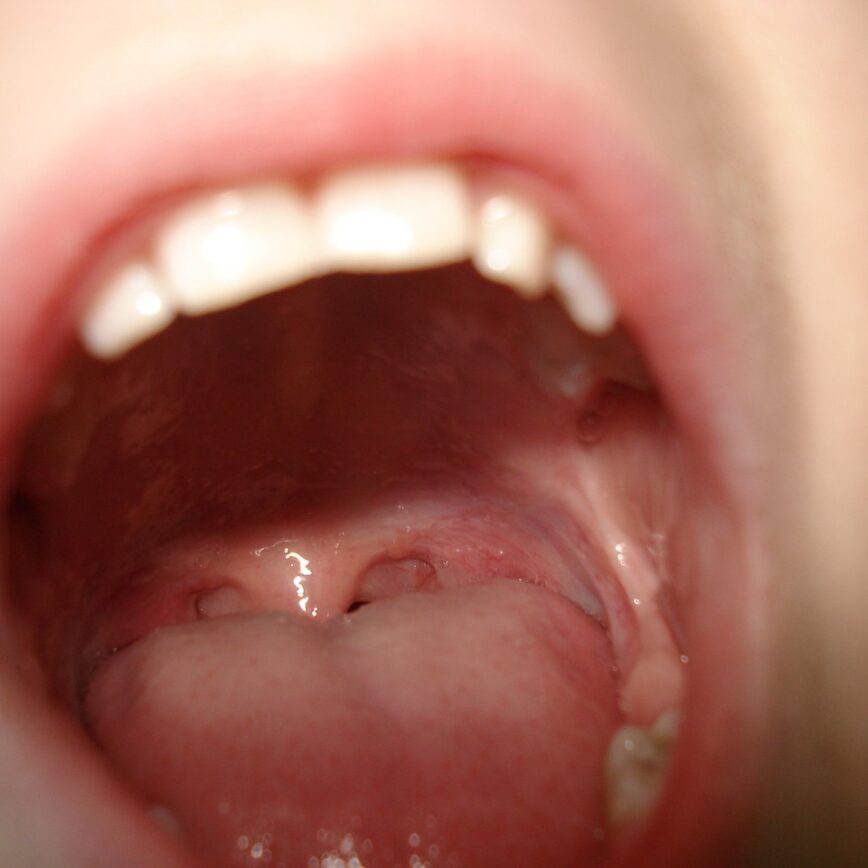 teeth, mouth, tongue, lips, cute, head, sweet, young, male, cheek, caucasian, mouth, mouth, mouth, mouth, tongue, tongue, tongue, tongue, tongue