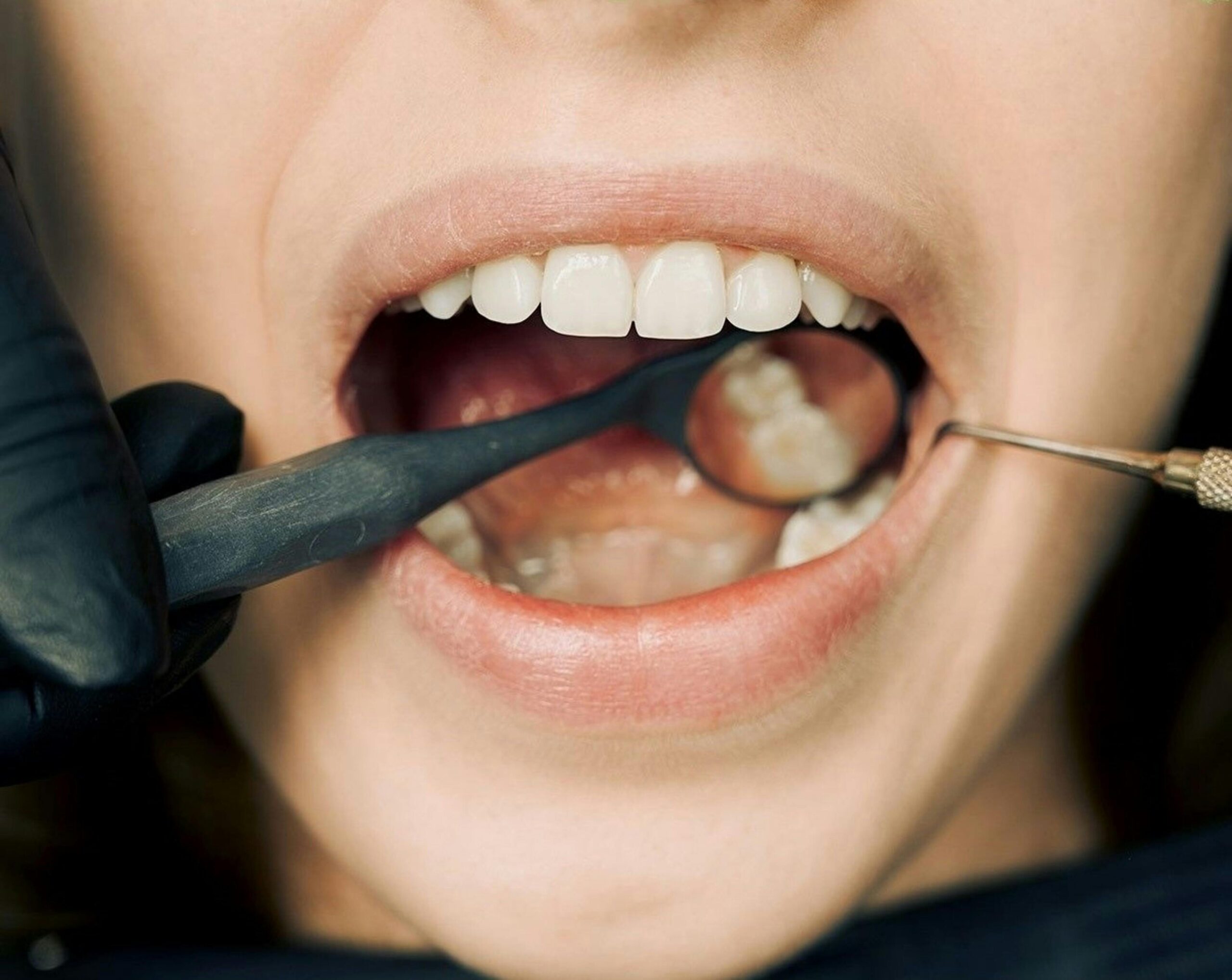Odontogener vs. Nicht-Odontogener Schmerz