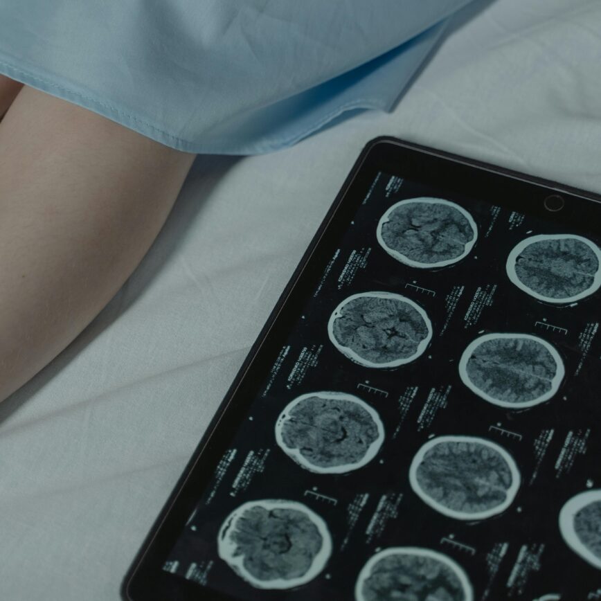 Close-up of brain CT scan display on tablet beside patient's legs in a hospital room.