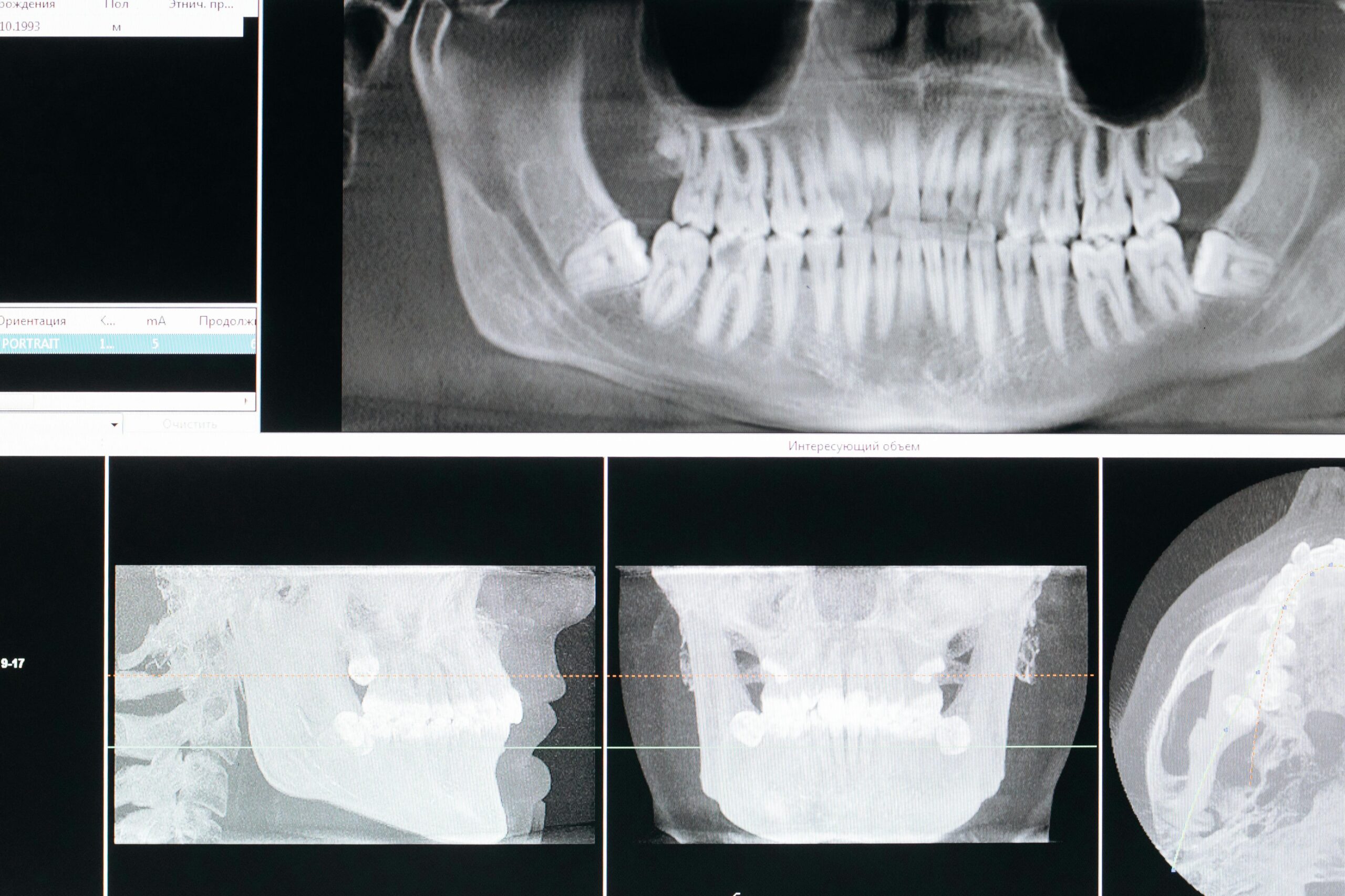 Leitlinien im Fokus: Übergreifende Themen – Halitosis, Risikopatienten & Notfälle