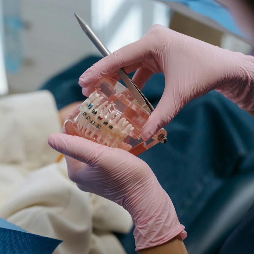Close-up of a dental professional using tools on a teeth model with braces.