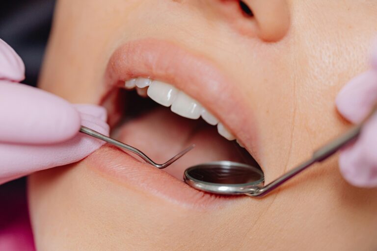 Close-up of a dental examination using dental tools for hygiene and care.