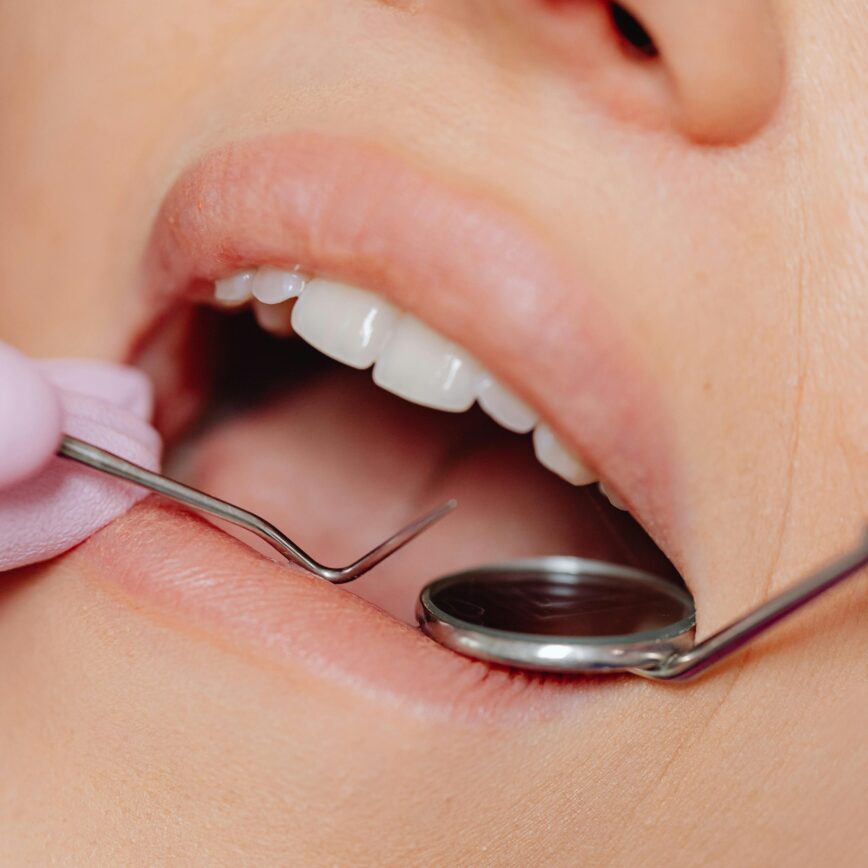Close-up of a dental examination using dental tools for hygiene and care.