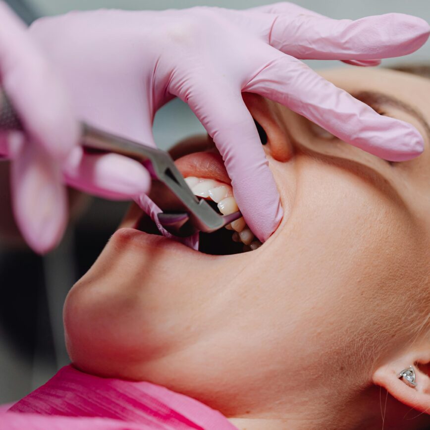 A patient receiving dental care, showcasing pink gloves and dental tools in a clinic setting.