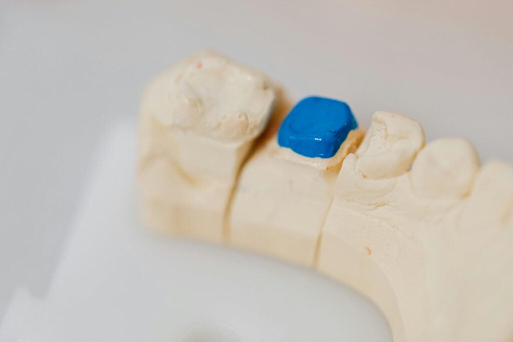pexels-photo-6627594-6627594 Close-up of a dental jaw model with a blue filling, showcasing dental anatomy and dentistry tools.