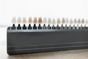 Detailed view of dental veneer shade guide for matching tooth color.