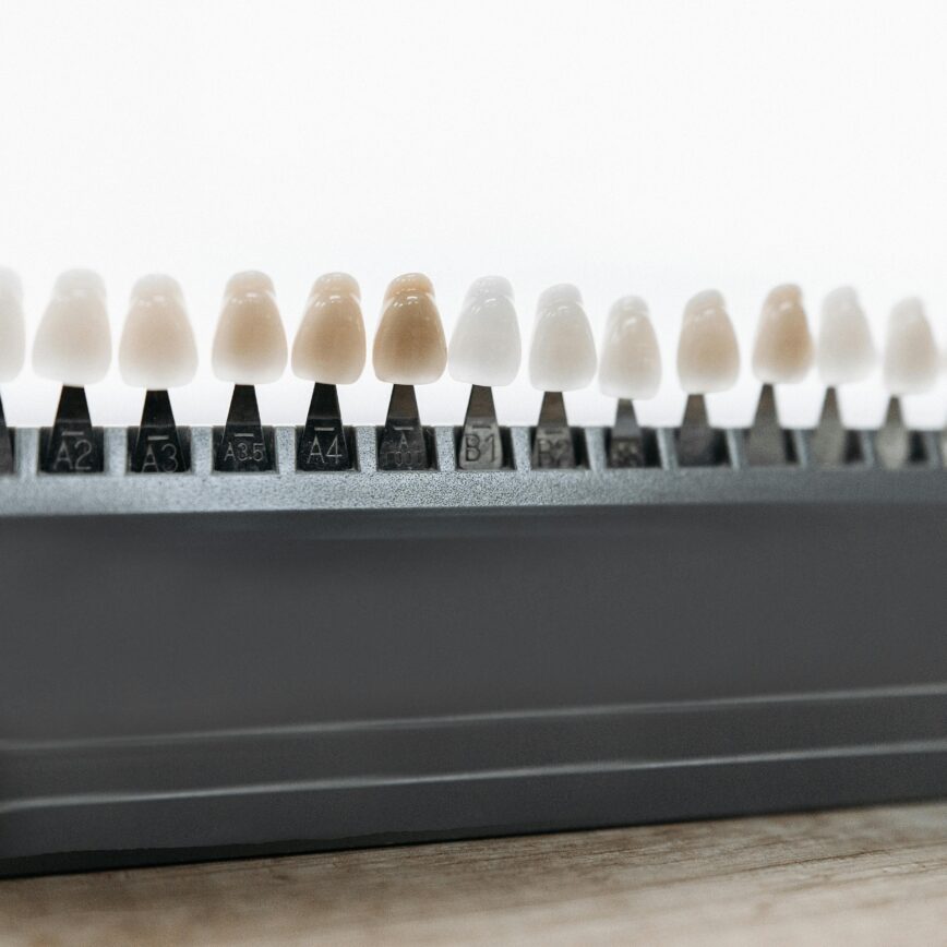 Detailed view of dental veneer shade guide for matching tooth color.