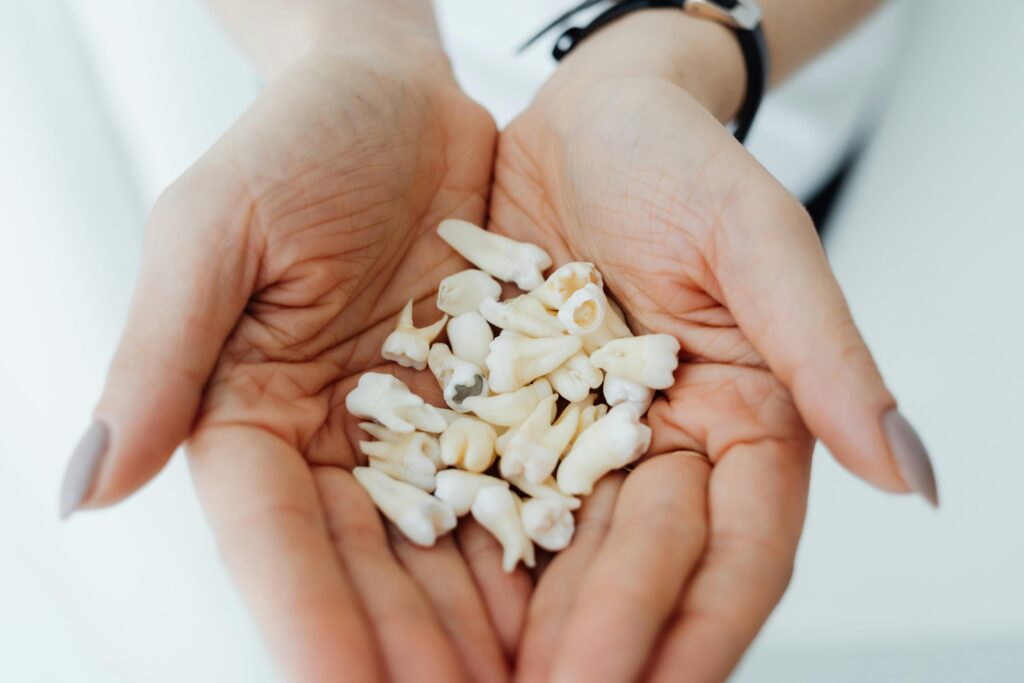pexels-photo-7195446-7195446 Close-up of hands gently holding a collection of human teeth, symbolizing dental health and care.
