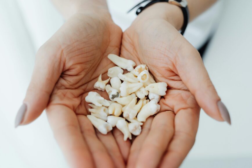 Close-up of hands gently holding a collection of human teeth, symbolizing dental health and care.