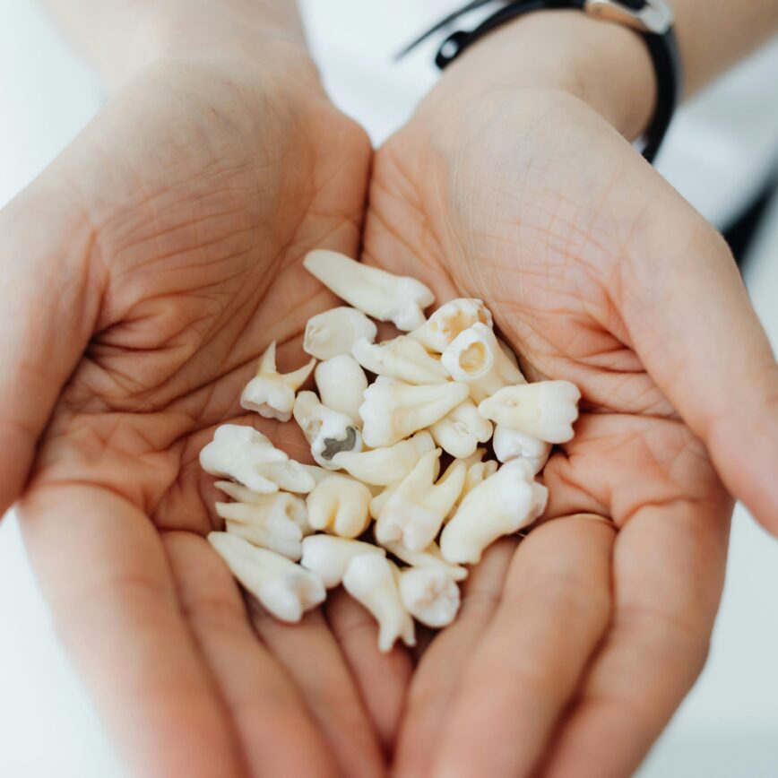 Close-up of hands gently holding a collection of human teeth, symbolizing dental health and care.