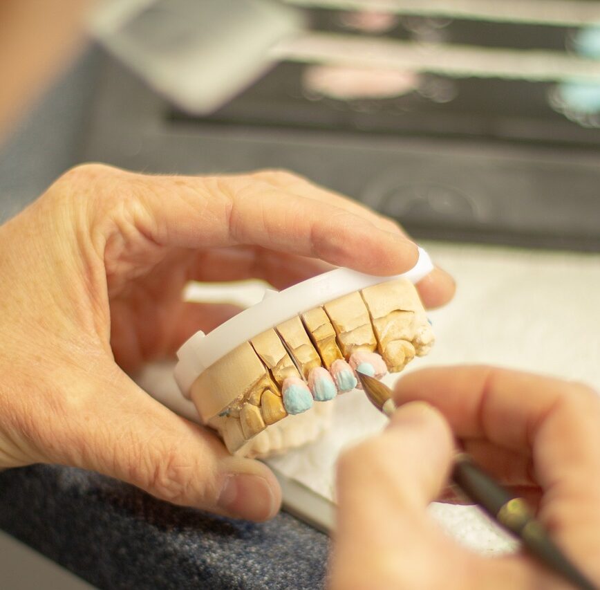 tooth replacement, dentist, healthcare, dentistry, smile, ceramic, applying, hand labor, person, clinic, equipment, brown smile, brown healthcare, dentist, dentist, dentistry, dentistry, dentistry, dentistry, dentistry
