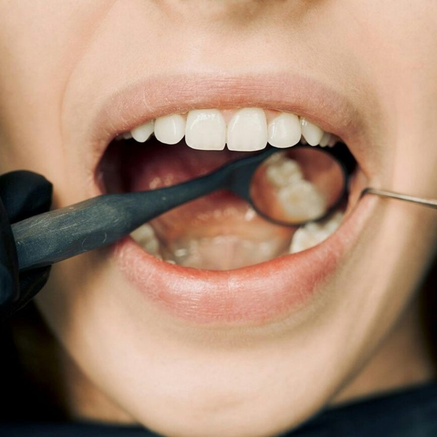 Close-up of a dental examination with modern equipment, showcasing oral hygiene maintenance.