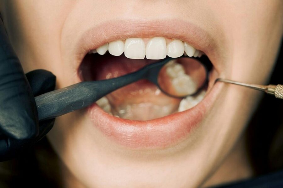 Close-up of a dental examination with modern equipment, showcasing oral hygiene maintenance.