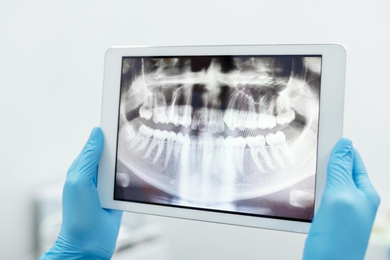 Blue-gloved hands holding a digital tablet displaying a detailed dental X-ray scan.