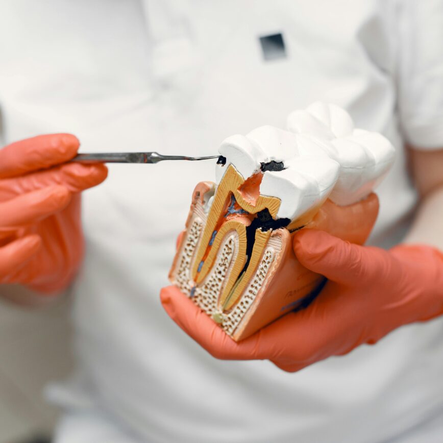 Close-up of dentist holding a tooth model, illustrating dental care concepts.
