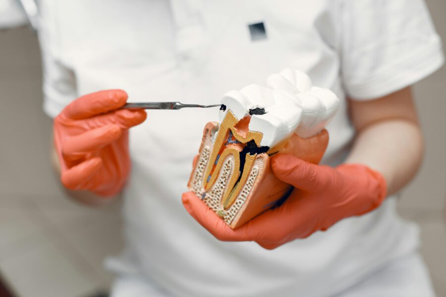 Close-up of dentist holding a tooth model, illustrating dental care concepts.